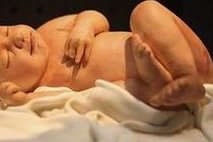 为何要在试管婴儿移植前打降调针 降调针有什么作用