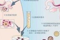 2026广西试管医院排行榜单！附选择试管医院的3要素